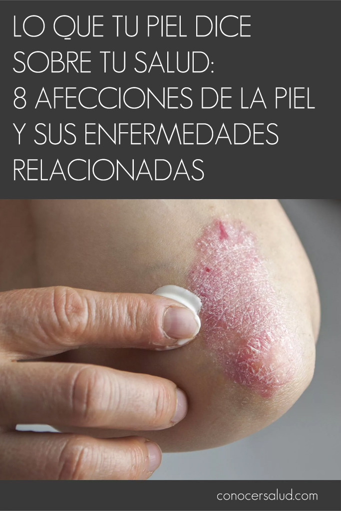 Lo que tu piel dice sobre tu salud: 8 afecciones de la piel y sus enfermedades relacionadas