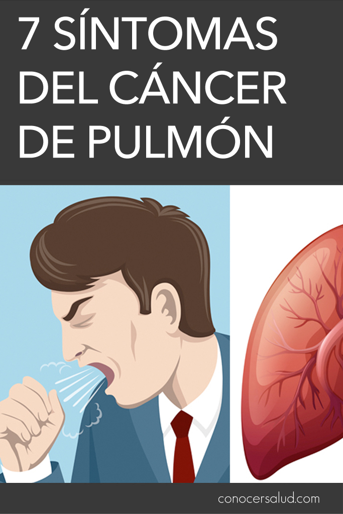 7 síntomas del cáncer de pulmón