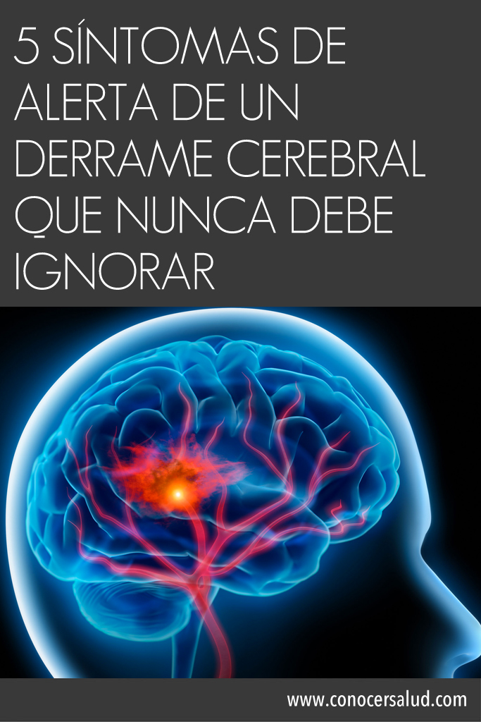 5 Síntomas de alerta de un derrame cerebral que nunca debe ignorar