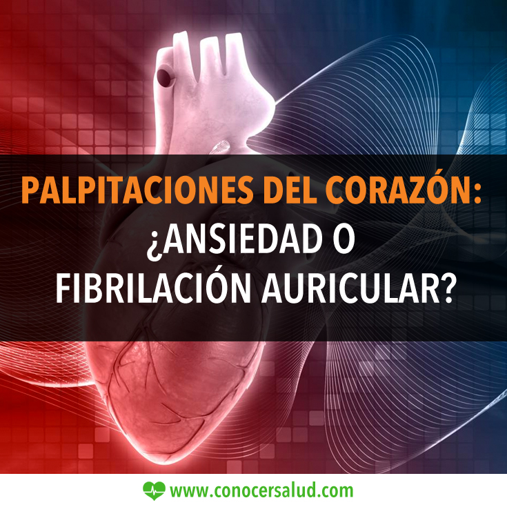 Palpitaciones del corazón: ¿ansiedad o fibrilación auricular?