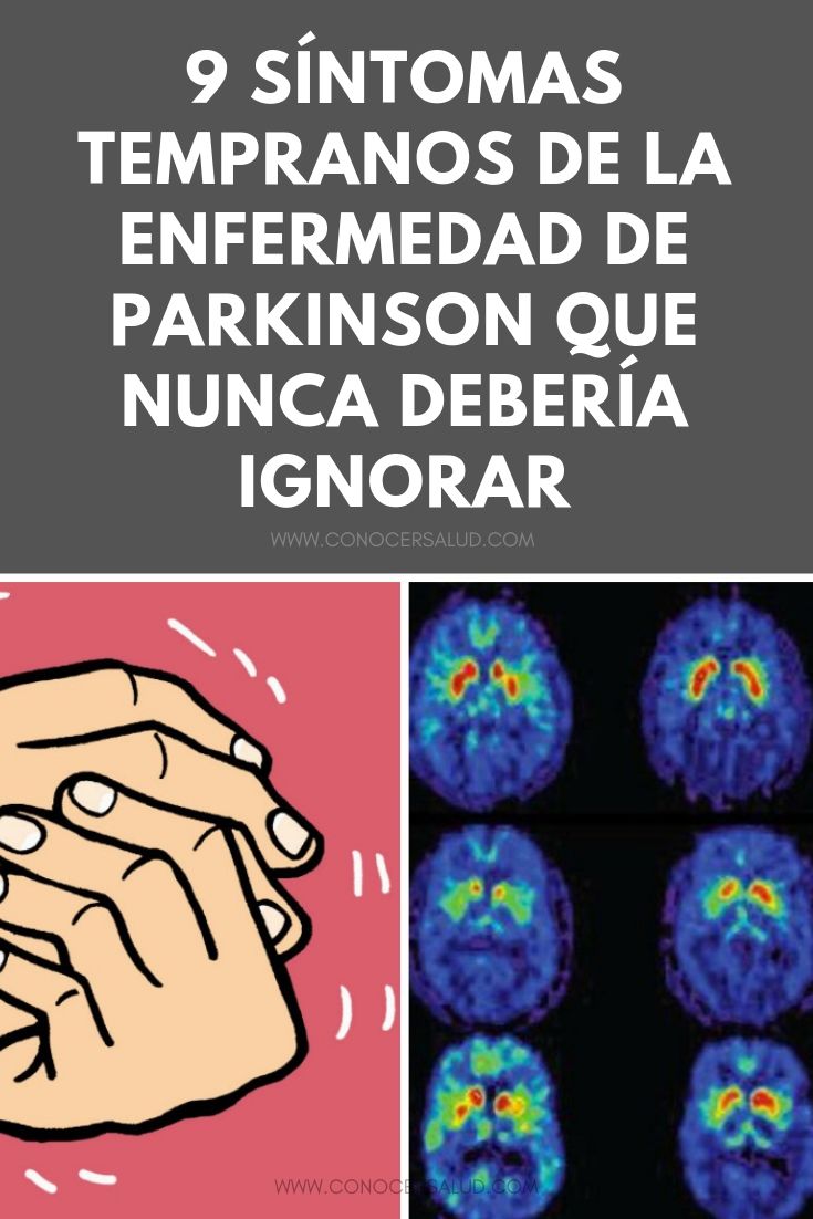 9 síntomas tempranos de la enfermedad de Parkinson que nunca debería ignorar