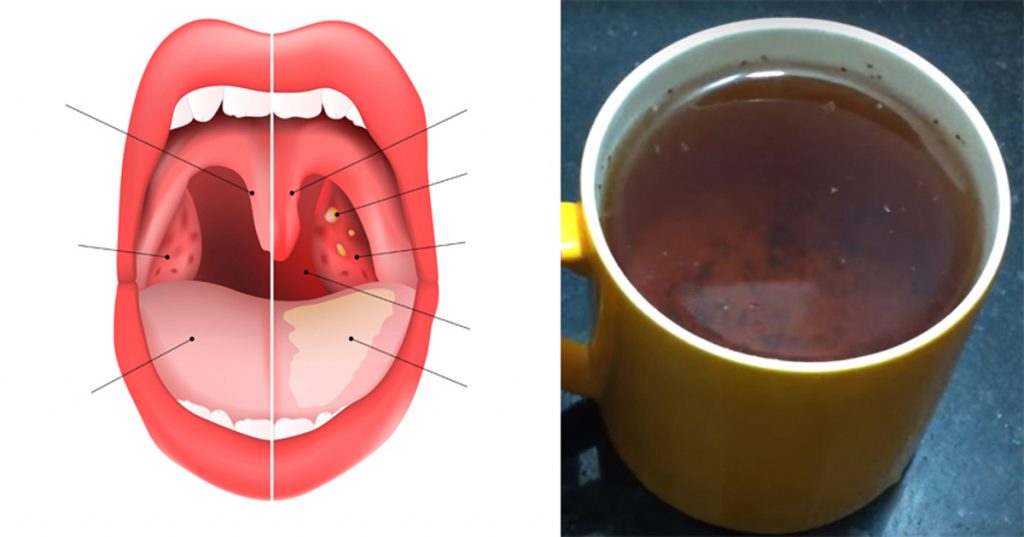 El té que cura la inflamación de garganta, las infecciones de los senos nasales y la gripe