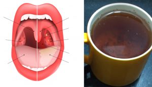 El té que cura la inflamación de garganta, las infecciones de los senos nasales y la gripe