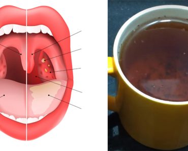 El té que cura la inflamación de garganta, las infecciones de los senos nasales y la gripe