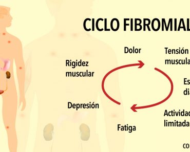 Un cuerpo excesivamente tóxico podría estar causando fibromialgia - Aquí está cómo arreglarlo