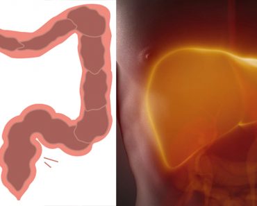 Esta "mala hierba" trata el estreñimiento, la diabetes y el daño hepático