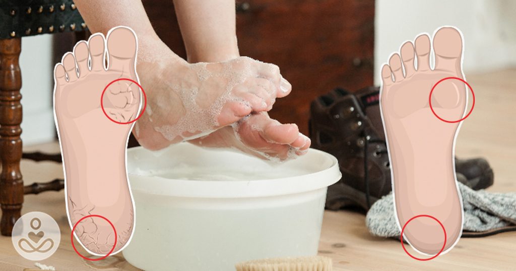 Remoje sus pies en esta mezcla cada 2 semanas para curar los pies secos y agrietados