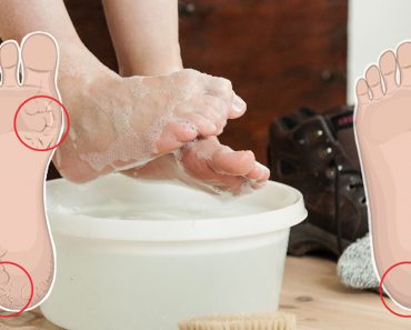 Remoje sus pies en esta mezcla cada 2 semanas para curar los pies secos y agrietados