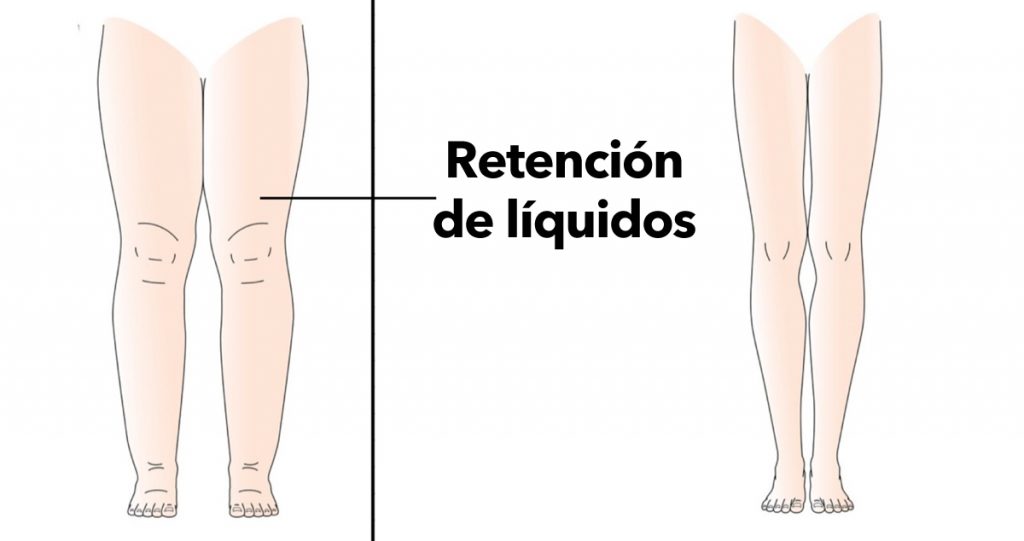 5 razones por las que su cuerpo retiene líquidos (y cómo evitarlo)