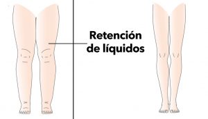 5 razones por las que su cuerpo retiene líquidos (y cómo evitarlo)