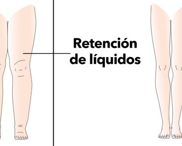 5 razones por las que su cuerpo retiene líquidos (y cómo evitarlo)