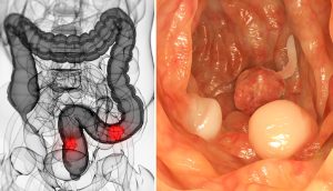 Según una investigación, éste compuesto de frutas mata las células madre del cáncer