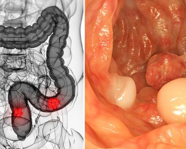 Según una investigación, éste compuesto de frutas mata las células madre del cáncer