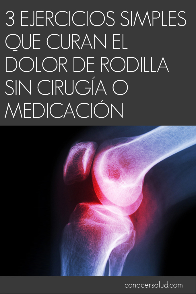 3 ejercicios simples que curan el dolor de rodilla sin cirugía o medicación