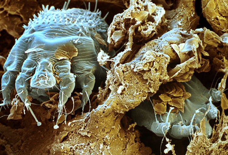 Identificando y diferenciando entre picaduras de insectos y mordeduras de arañas