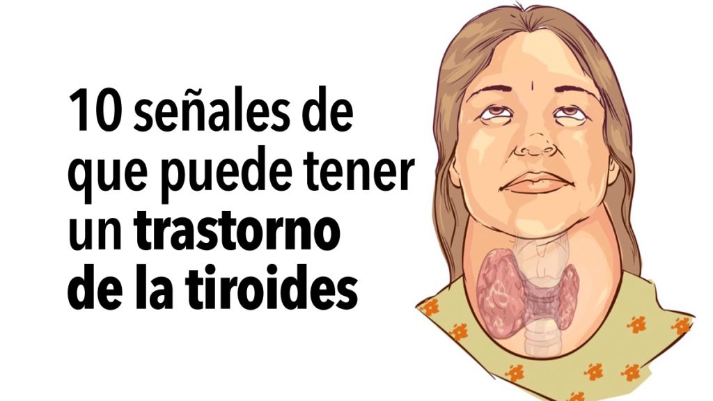 10 señales de que puede tener un trastorno de la tiroides