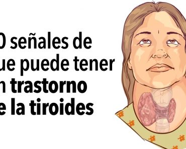 10 señales de que puede tener un trastorno de la tiroides