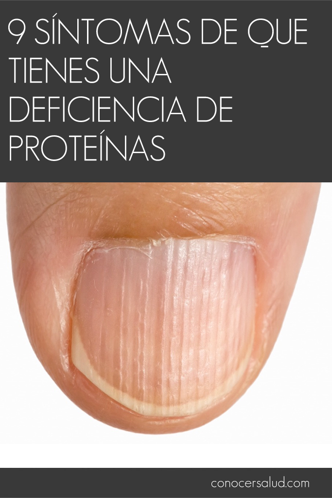 9 síntomas de que tienes una deficiencia de proteínas