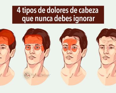 4 tipos de dolores de cabeza que nunca debes ignorar