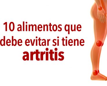 10 alimentos que debe evitar si tiene artritis
