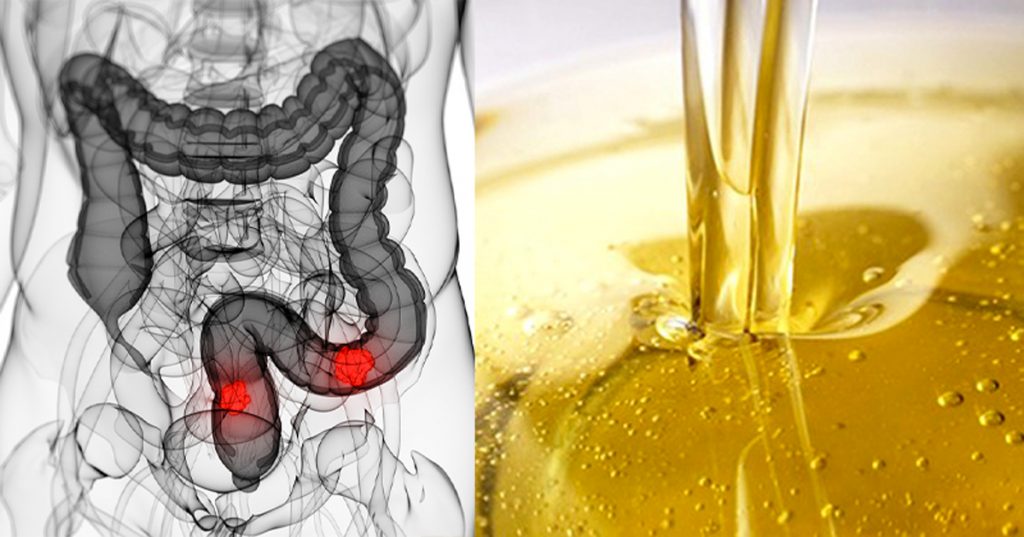 Canadá prohíbe un peligroso aceite relacionado con cáncer, alteración hormonal y ataque cardiaco