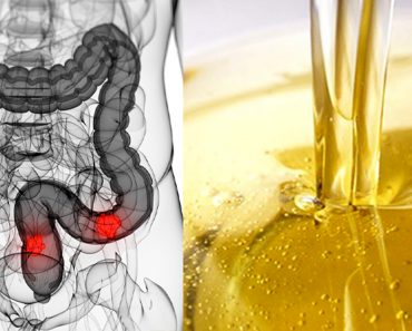 Canadá prohíbe un peligroso aceite relacionado con cáncer, alteración hormonal y ataque cardiaco