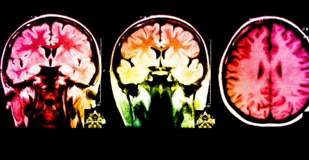 Científicos dicen que la canción más relajante del mundo reduce la ansiedad y el estrés en un 65% [escúchala]