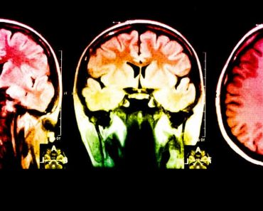 Científicos dicen que la canción más relajante del mundo reduce la ansiedad y el estrés en un 65% [escúchala]