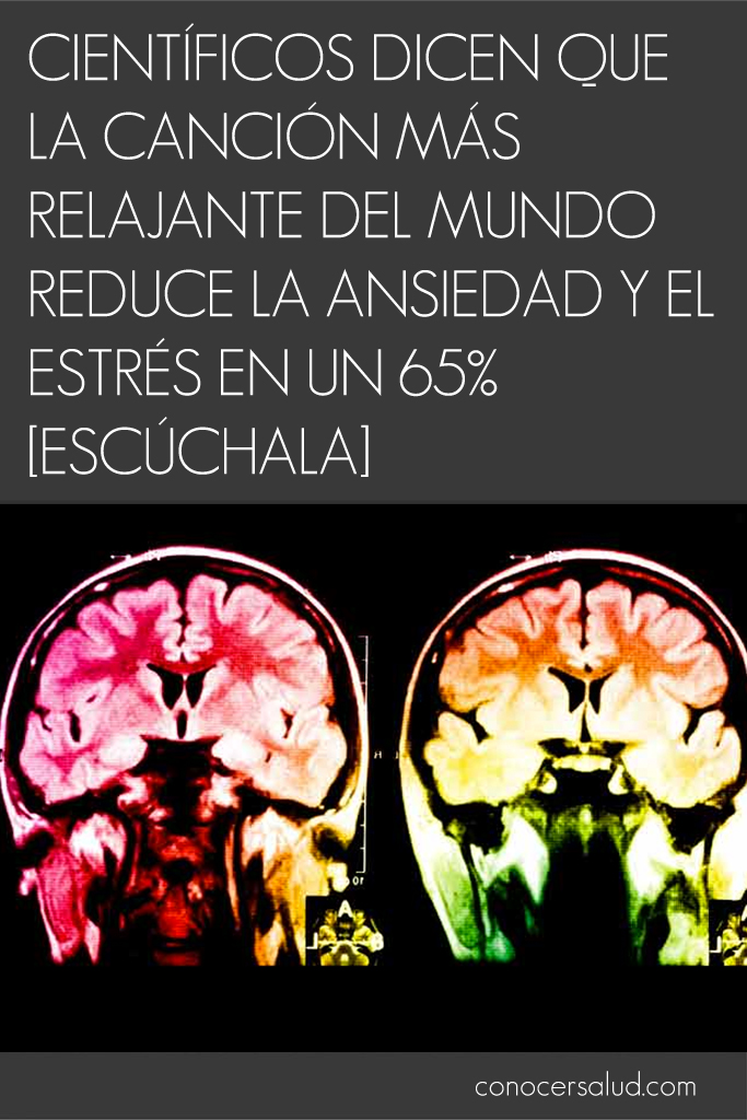 Científicos dicen que la canción más relajante del mundo reduce la ansiedad y el estrés en un 65% [escúchala]