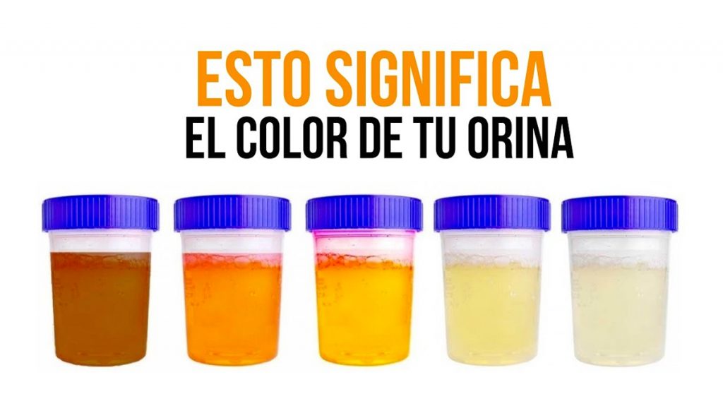 ¿De qué color es tu orina? Esto es lo que significa para tu salud…