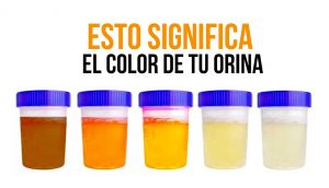 ¿De qué color es tu orina? Esto es lo que significa para tu salud…