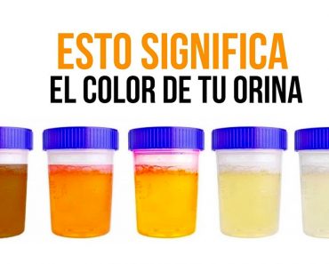 ¿De qué color es tu orina? Esto es lo que significa para tu salud…