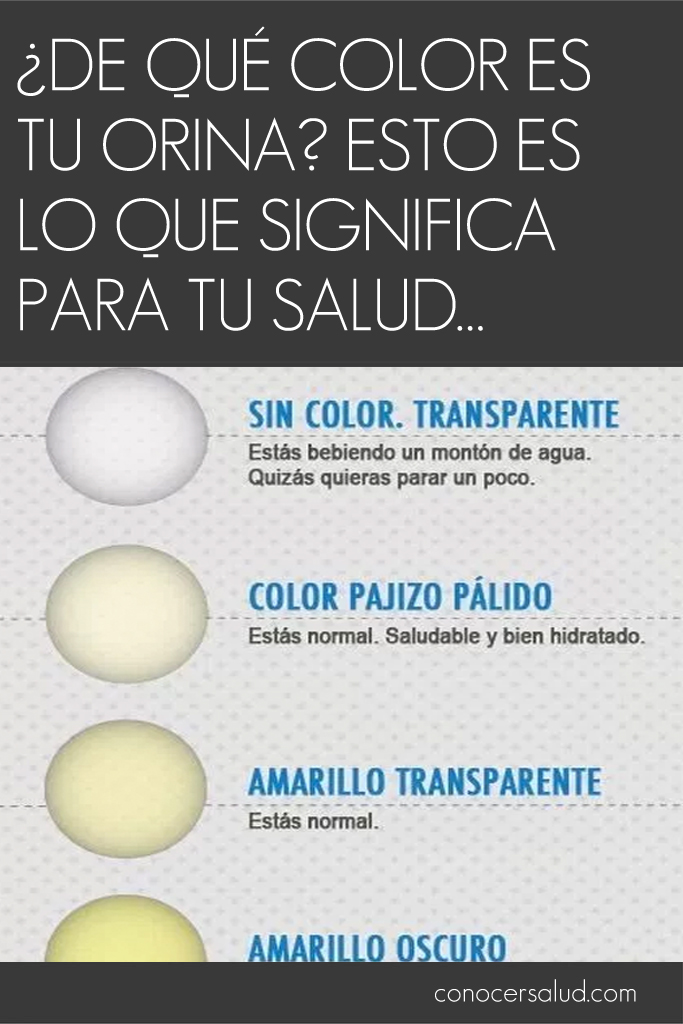 ¿De qué color es tu orina? Esto es lo que significa para tu salud…