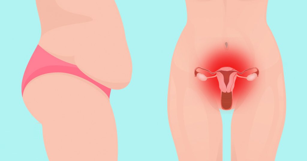 Aumento de peso en la menopausia: 4 hormonas distintas del estrógeno que necesitan su atención