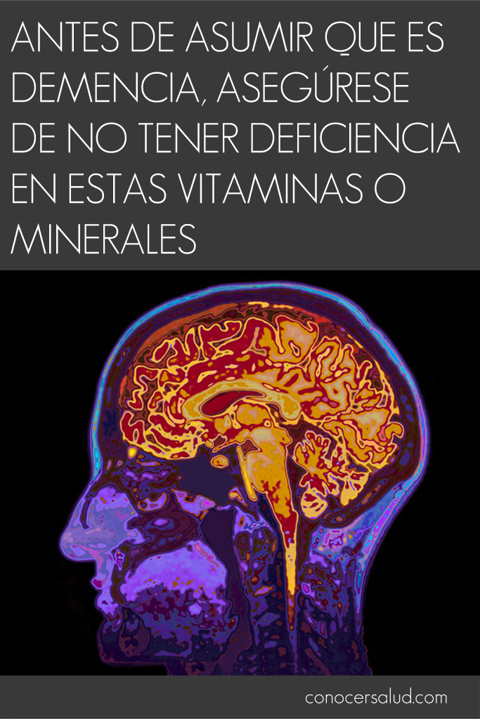 Antes de asumir que es demencia, asegúrese de no tener deficiencia en estas vitaminas o minerales