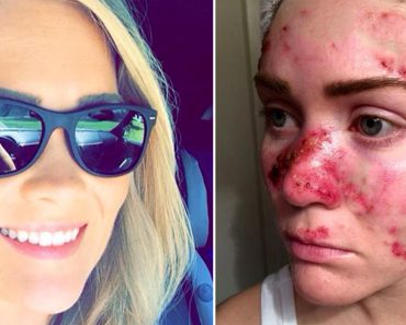 Una mujer comparte una selfie para ayudar a acabar con un hábito que casi la mata