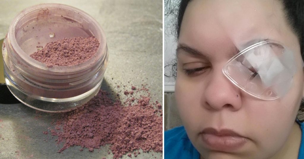 Esta madre perdió un ojo debido a un error común de maquillaje