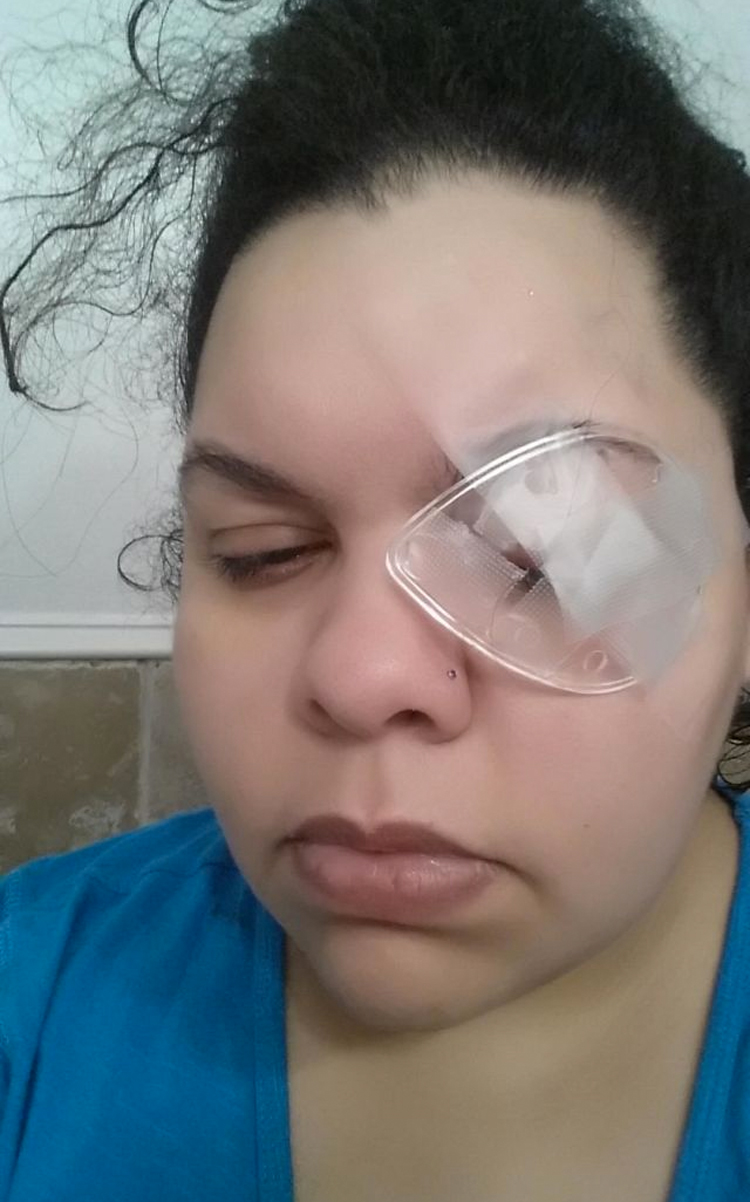 Esta madre perdió un ojo debido a un error común de maquillaje