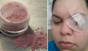 Esta madre perdió un ojo debido a un error común de maquillaje