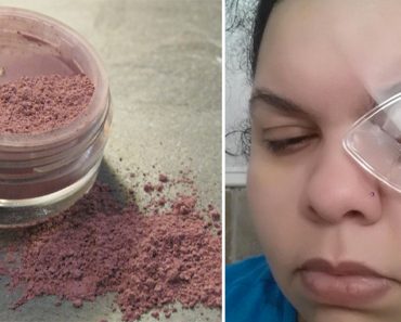 Esta madre perdió un ojo debido a un error común de maquillaje