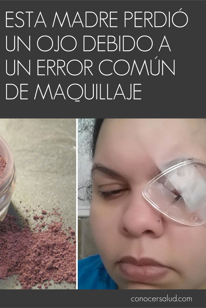 Esta madre perdió un ojo debido a un error común de maquillaje