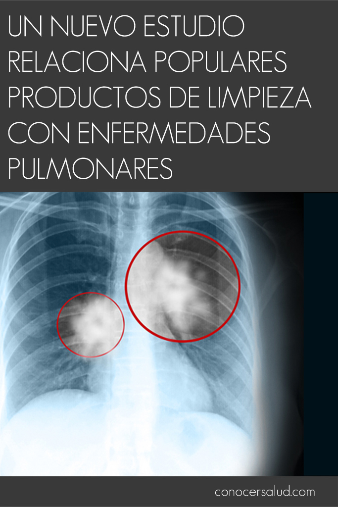 Un nuevo estudio relaciona populares productos de limpieza con enfermedades pulmonares