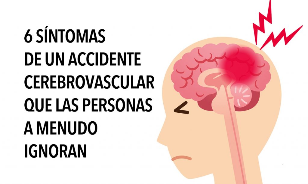 6 síntomas de un accidente cerebrovascular que las personas a menudo ignoran