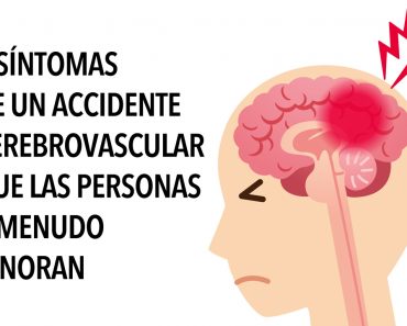 6 síntomas de un accidente cerebrovascular que las personas a menudo ignoran