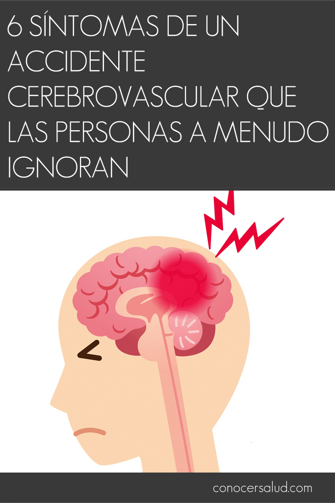 6 síntomas de un accidente cerebrovascular que las personas a menudo ignoran