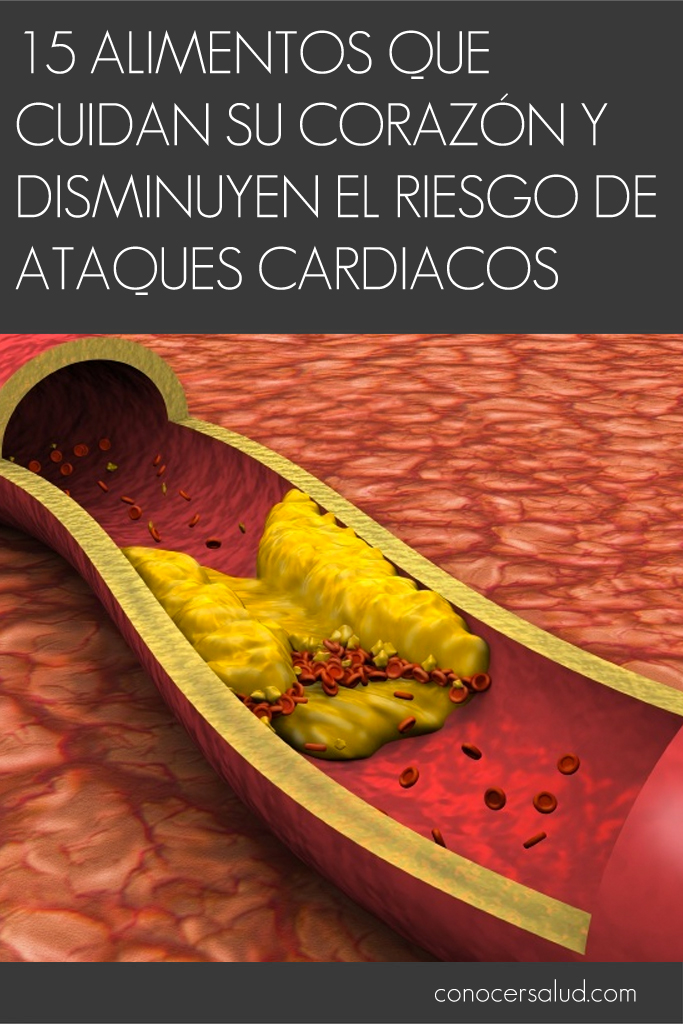 15 Alimentos que cuidan su corazón y disminuyen el riesgo de ataques cardiacos