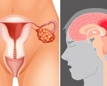 Esta potente fruta reduce la probabilidad de accidente cerebrovascular, cáncer y presión arterial alta