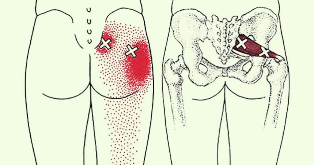 6 estiramientos para la ciática para prevenir y aliviar el dolor de cadera y espalda baja