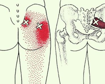 6 estiramientos para la ciática para prevenir y aliviar el dolor de cadera y espalda baja