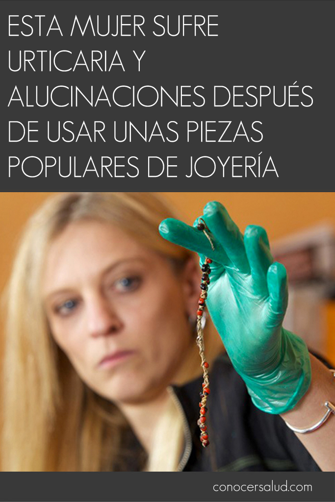 Esta mujer sufre urticaria y alucinaciones después de usar unas piezas populares de joyería